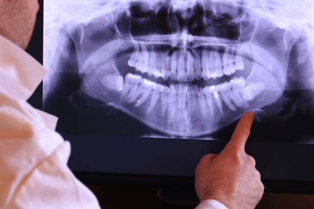 Best Emergency Root Canal Treatment in Frederic, WI