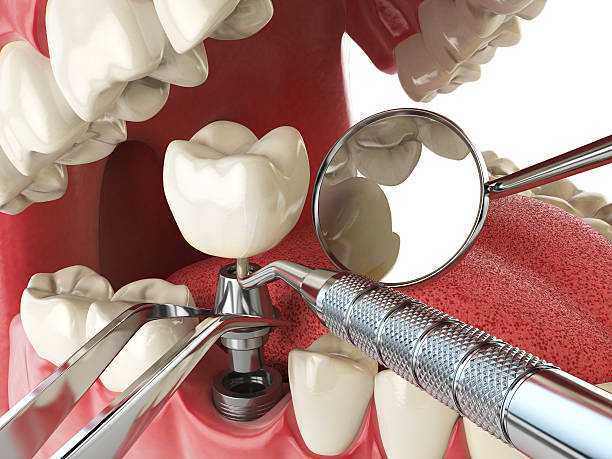 Best Emergency TMJ Treatment in Frederic, WI