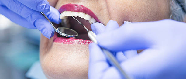 Best Emergency Dental Care for Broken or Chipped Teeth in Frederic, WI